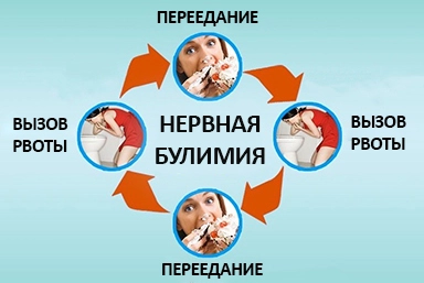 Лечение булимии в городе Бавлы